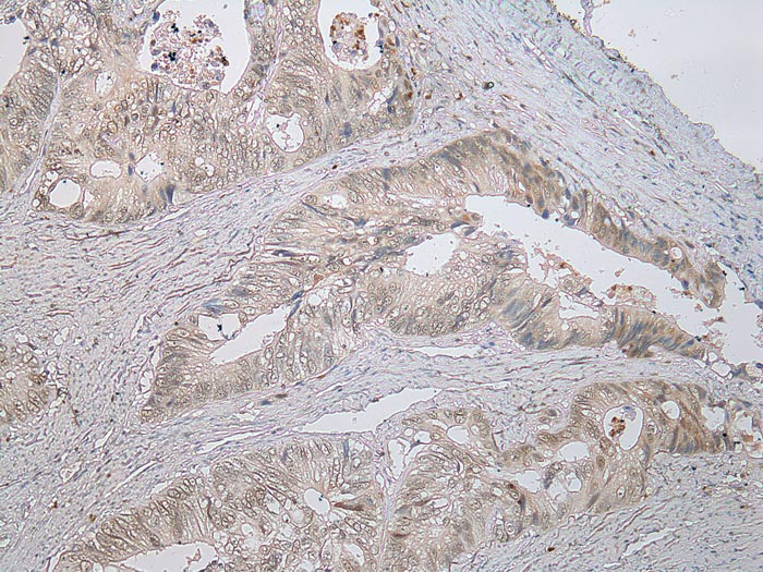 STAB1 Antibody