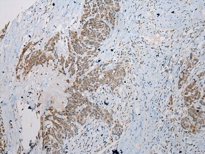 STAB1 Antibody