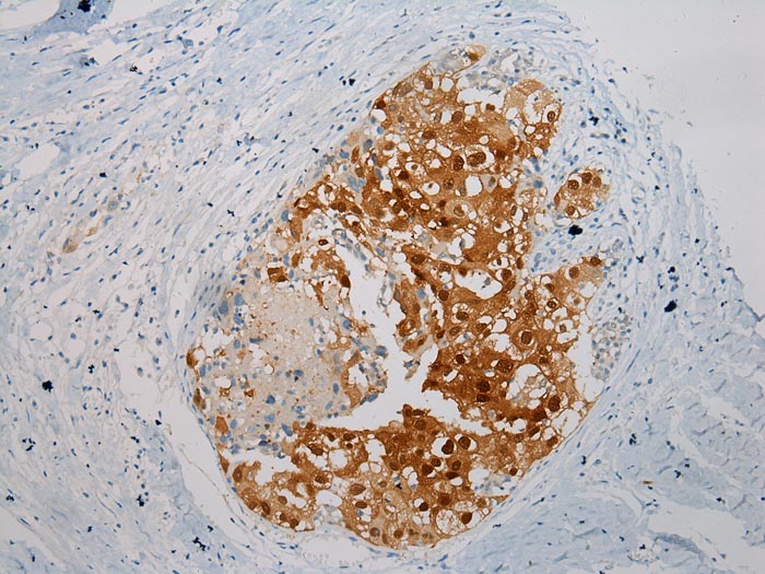 THBS2 Antibody