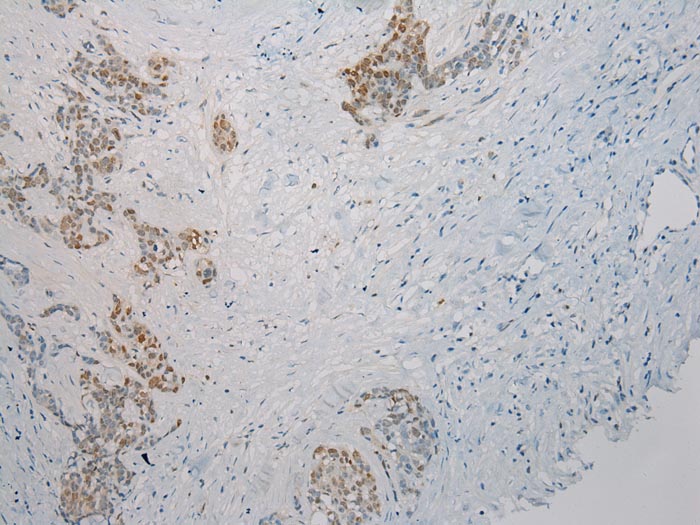 THBS2 Antibody