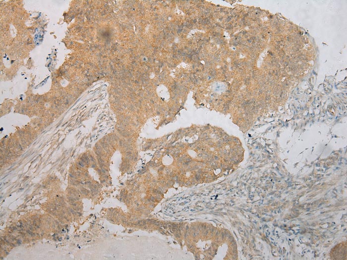 TM7SF2 Antibody