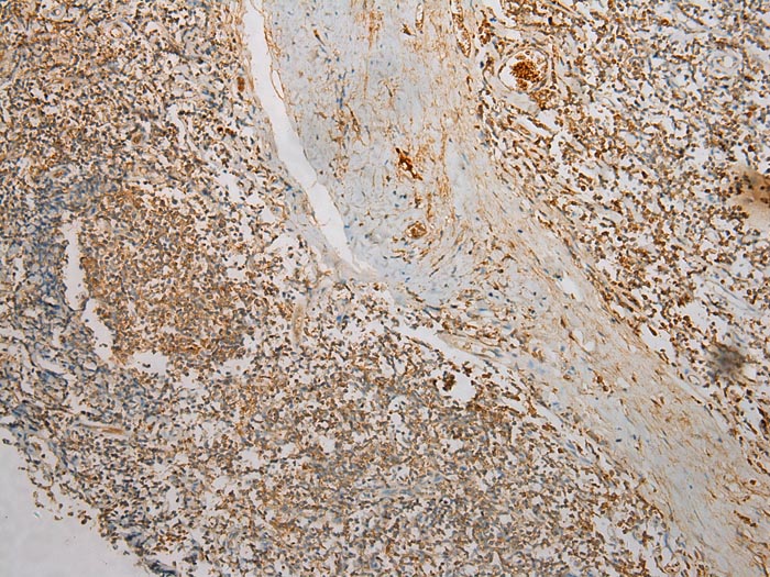 TMPRSS11F Antibody