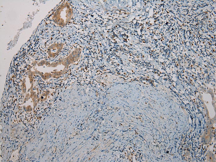 TNIP1 Antibody