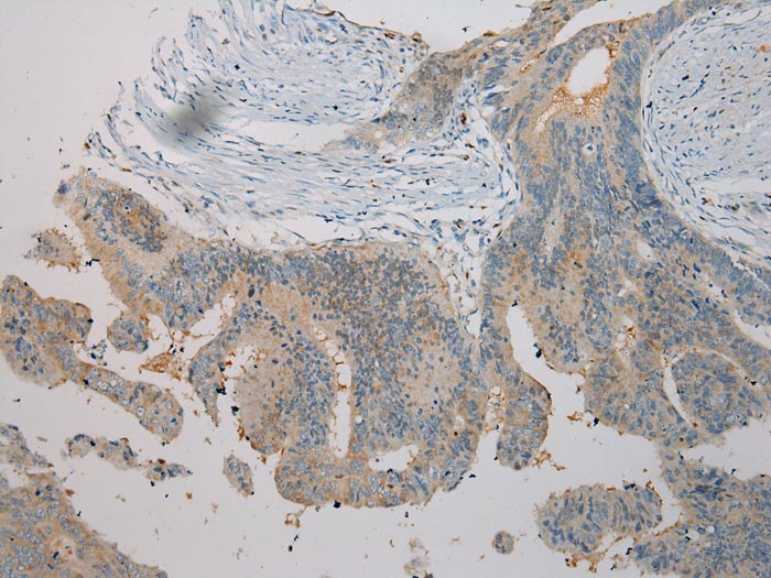 TNIP1 Antibody