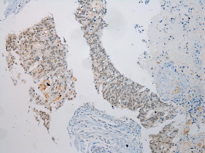 UTS2B Antibody