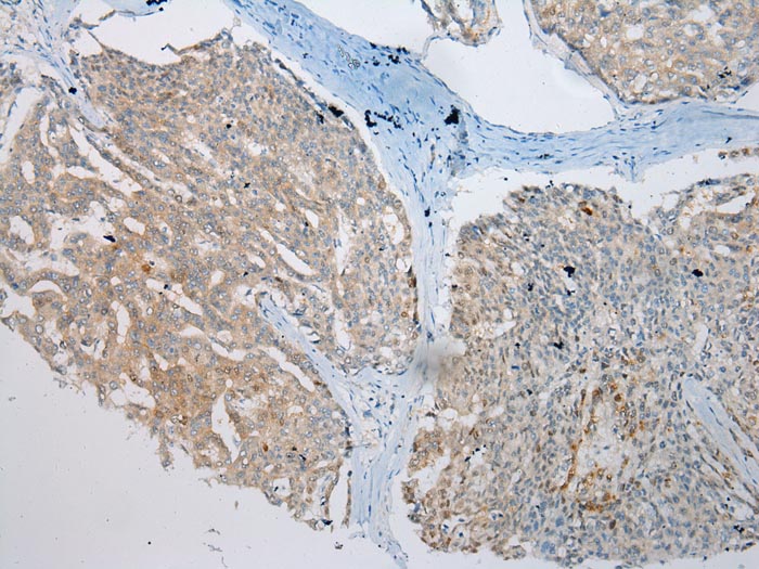 VPS4A Antibody
