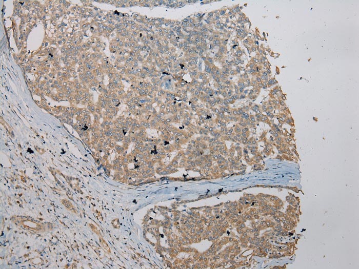 VPS36 Antibody