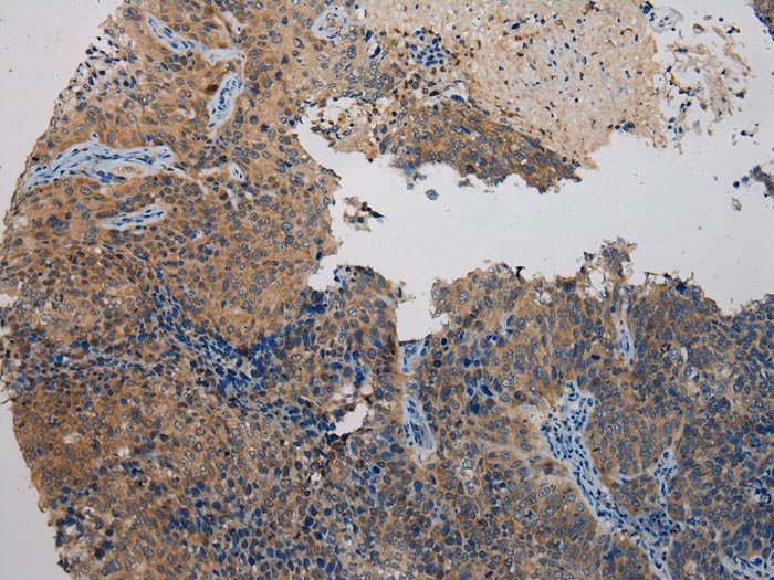 WDR45B Antibody
