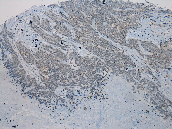 WNK2 Antibody