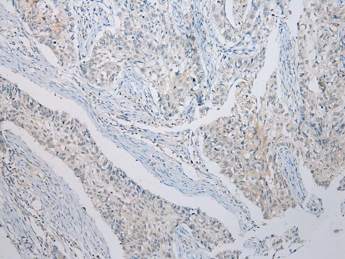 RASSF3 Antibody