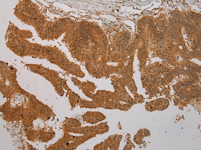 SEMA4G Antibody