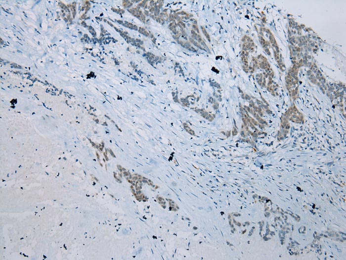 SERPINB11 Antibody