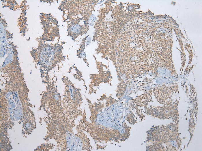 SSBP4 Antibody