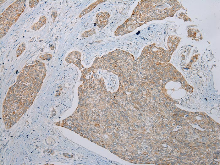 TRIM49 Antibody
