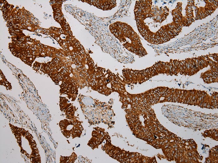 TXNDC5 Antibody