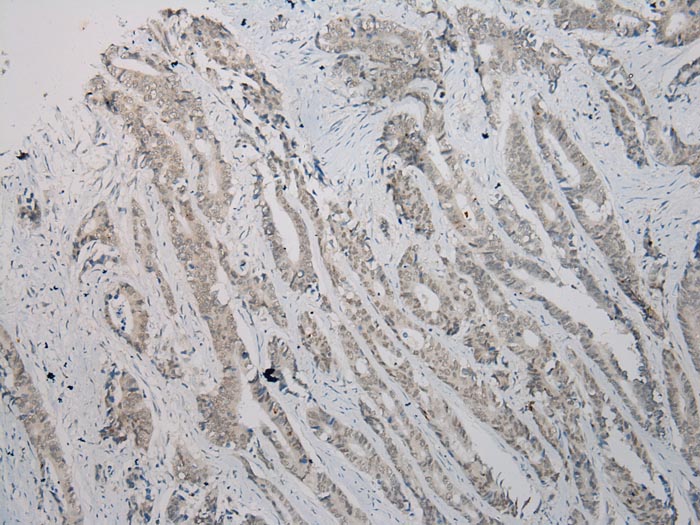 TBL1Y Antibody