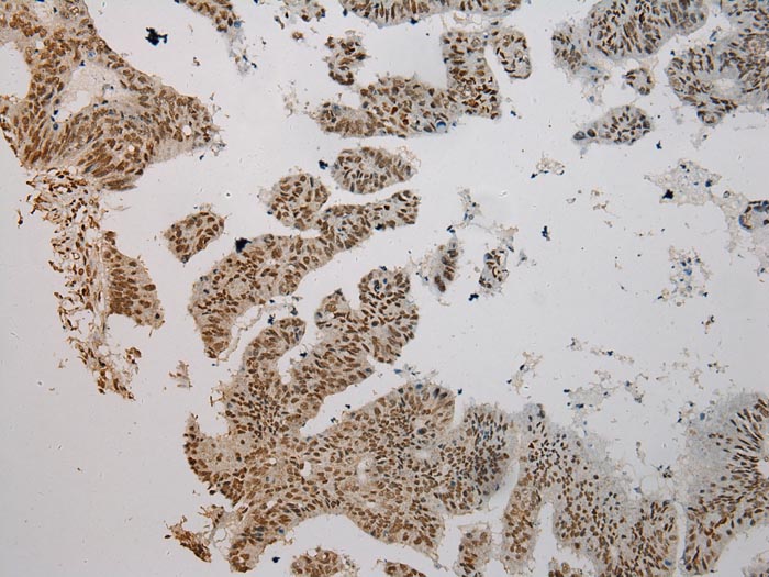 AGPAT9 Antibody
