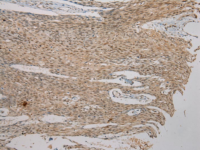 AGPAT9 Antibody