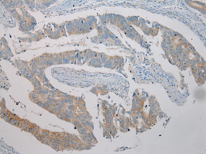 TRIM45 Antibody