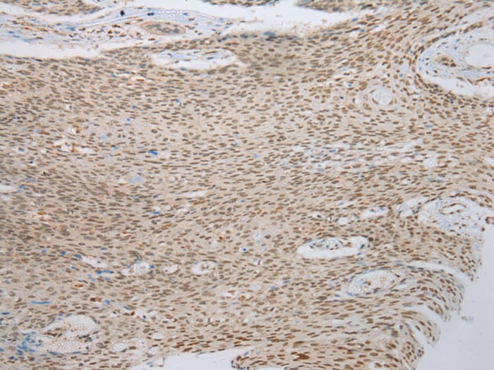 ANKRD1 Antibody