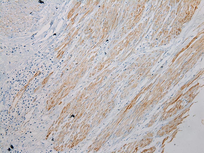 SESN3 Antibody