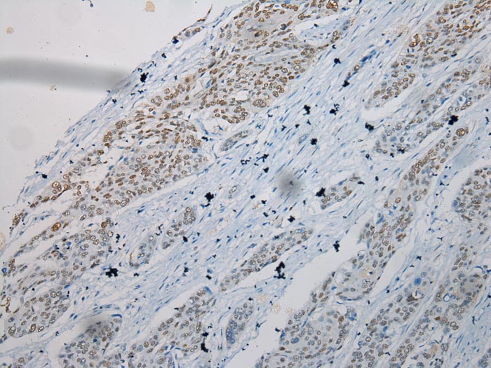 TKT Antibody