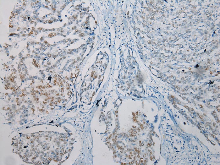 TKT Antibody