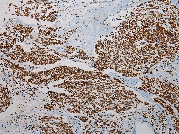 TRPC4AP Antibody