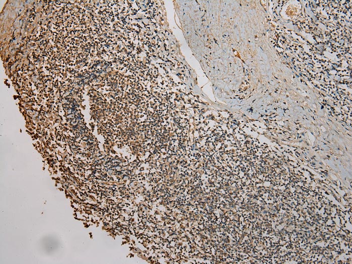 UBE2B Antibody