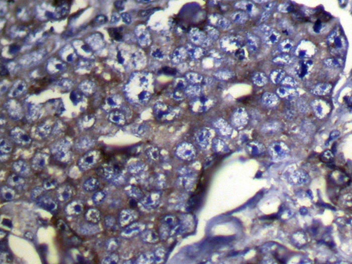 DUSP11 Antibody
