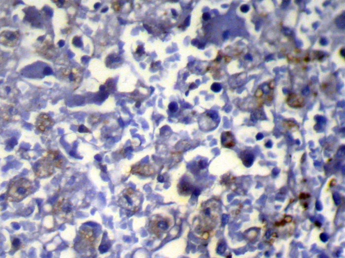 VPS37A Antibody