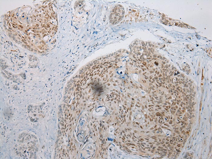 WDR45 Antibody