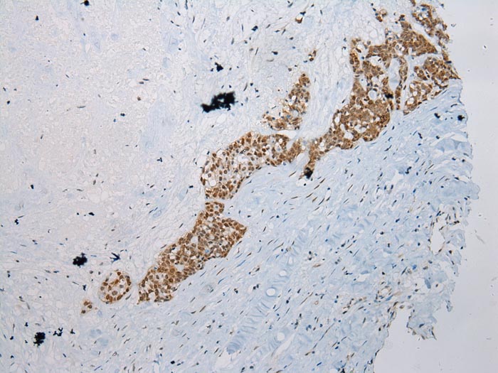 WDR45 Antibody