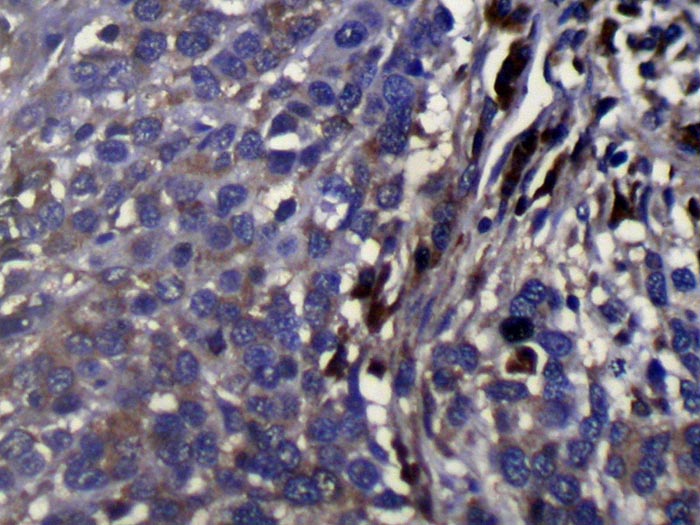 WDR61 Antibody