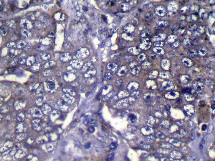 WDR61 Antibody