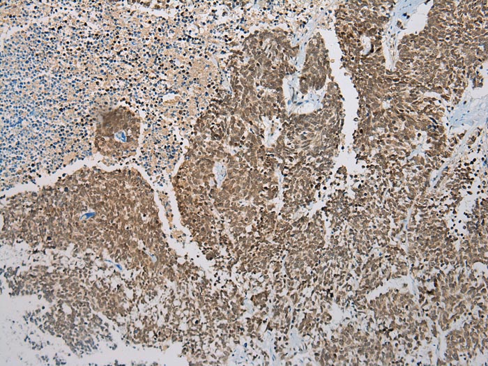 DCAF7 Antibody