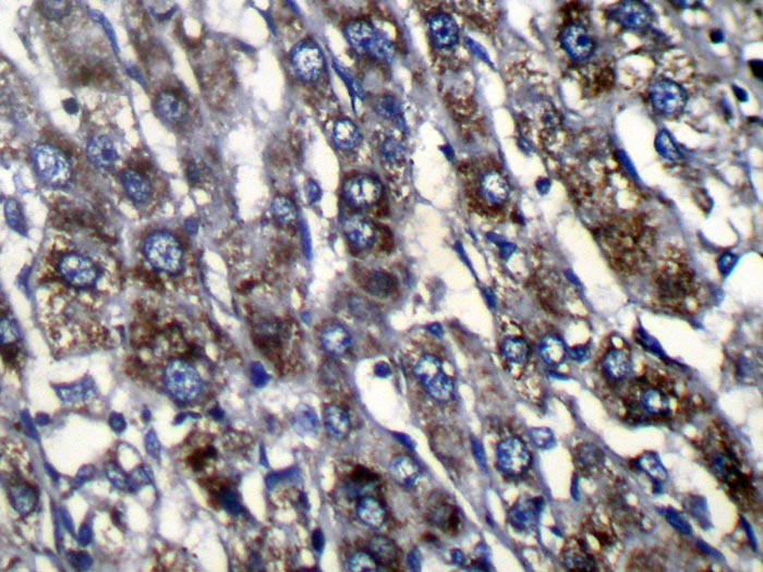 ZFAND3 Antibody