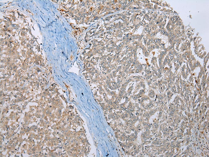 MLLT11 Antibody