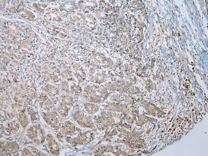 MLLT11 Antibody