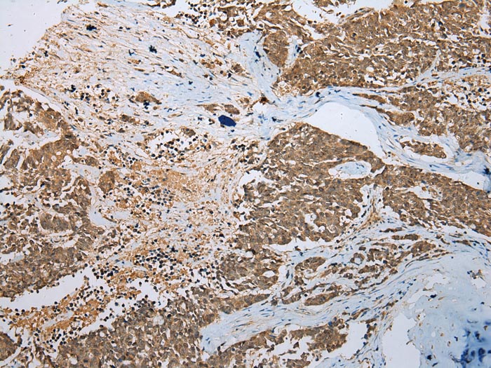 PHTF2 Antibody