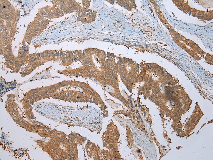 PHTF2 Antibody
