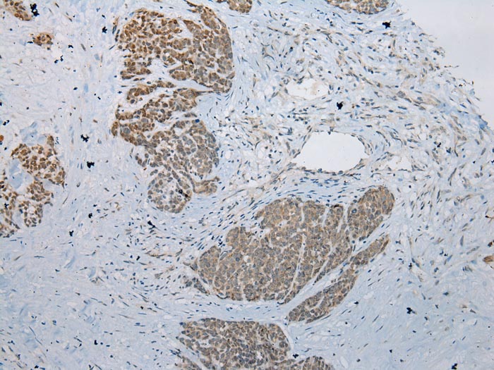 LSM11 Antibody