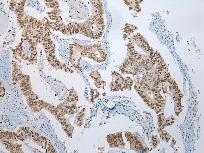 ZNF486 Antibody