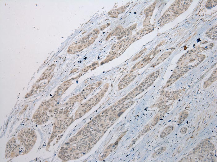 POMK Antibody