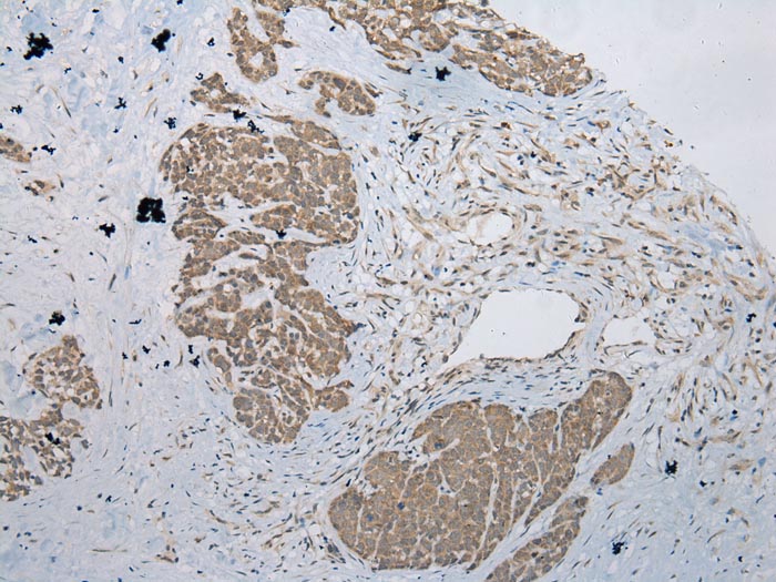 POMK Antibody