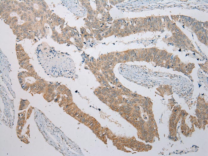 ITLN2 Antibody