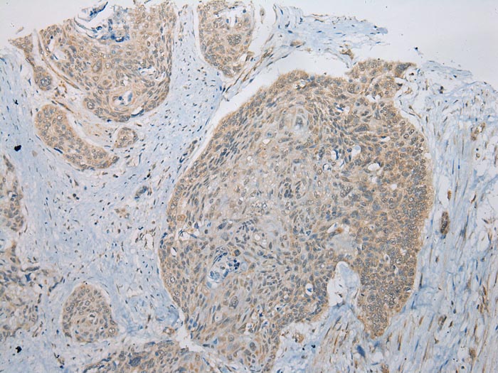 ITLN2 Antibody