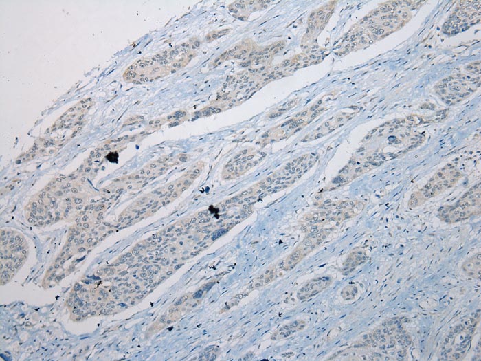 THEMIS2 Antibody