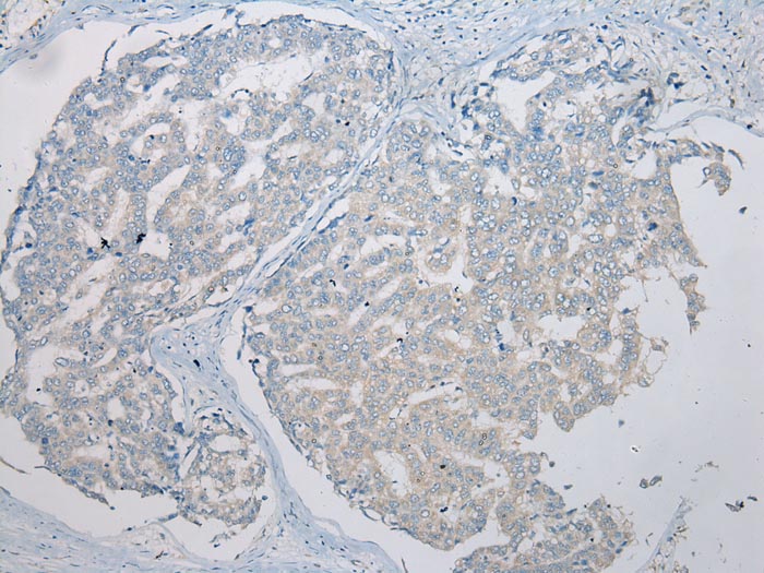 THEMIS2 Antibody