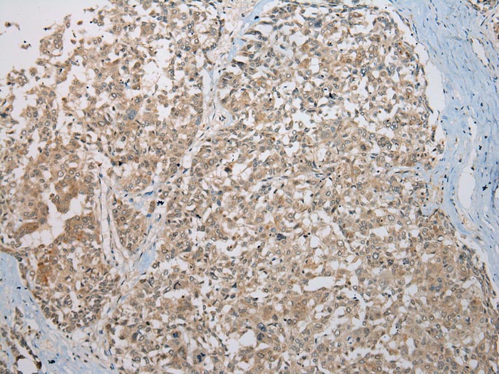 KAZN Antibody